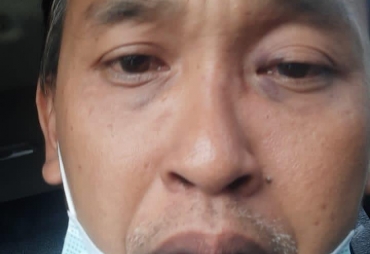 Preman Kampung Beraksi Aniaya Satu Keluarga di Wisata Danau Lau Kawar Karo
