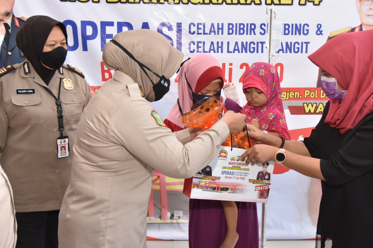 RS Bhayangkara Batam Gelar Operasi Bibir Sumbing