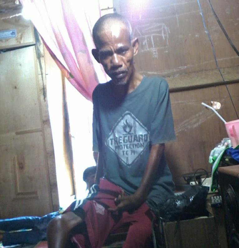 Miliki Keterbatasan Fisik Warga Batu Bara Ini Harapkan Bantuan Dermawan