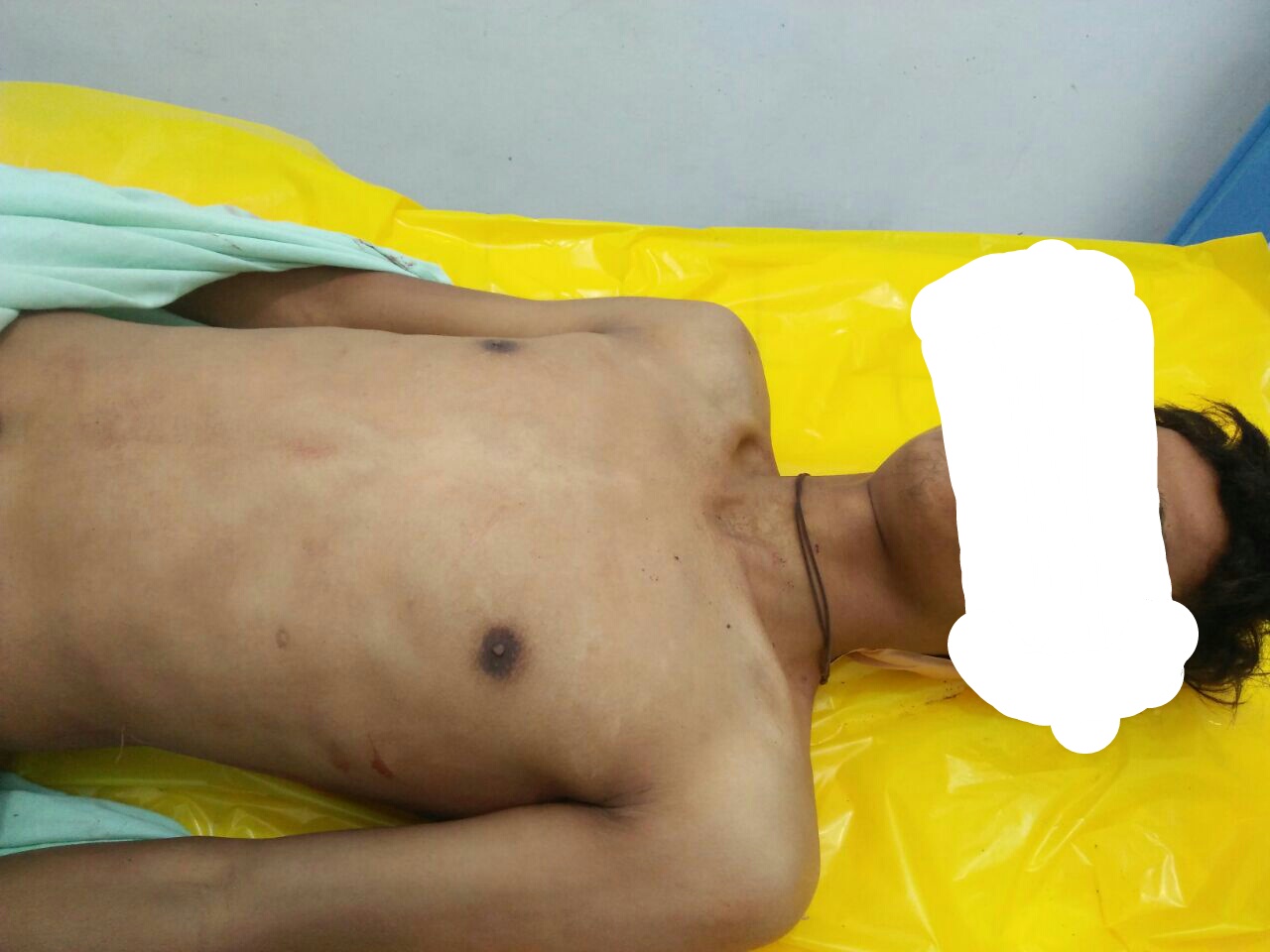 Tampak jenazah Tanpa Identitas Berada di Kamar Jenazah 