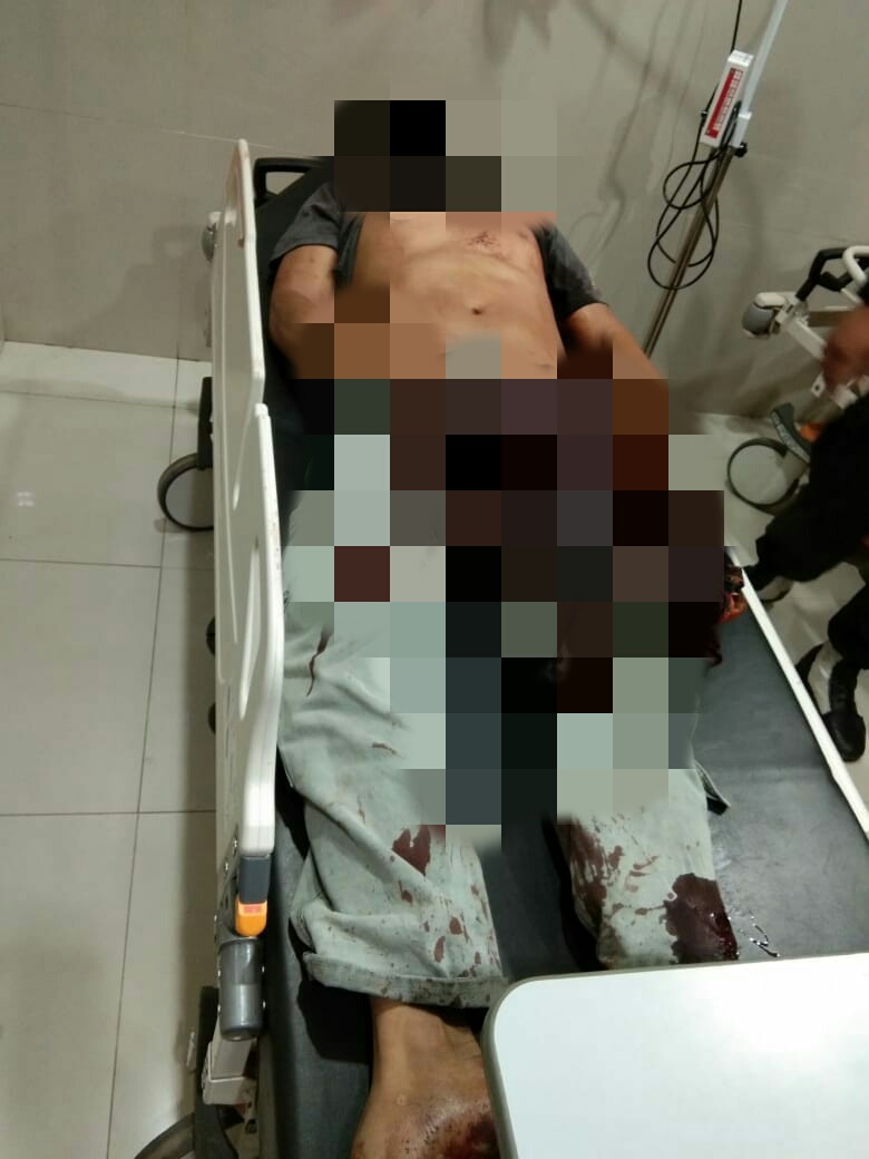 Tampak Korban yang mengalami luka-luka hingga Tewas 