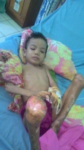 Rehan Butuh Uluran Tangan Sosok Dermawan