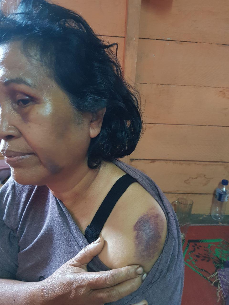 Tampak Korban yang mengalami kesakitan dan sejumlah lebam