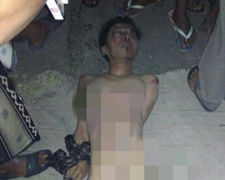 Pelaku curanmor tewas mengenaskan diamuk masa setelah di bawa ke rumah sakit proklamasi