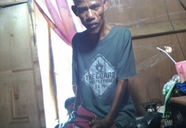 Miliki Keterbatasan Fisik Warga Batu Bara Ini Harapkan Bantuan Dermawan