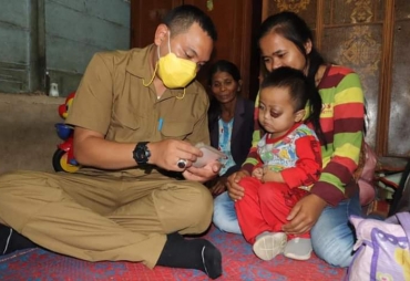 Anak Penderita Tumor Mata Dapat Perhatian Dari Bupati Pakpak Bharat