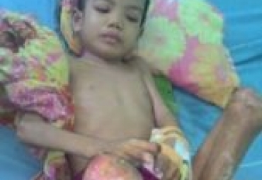 Rehan Butuh Uluran Tangan Sosok Dermawan