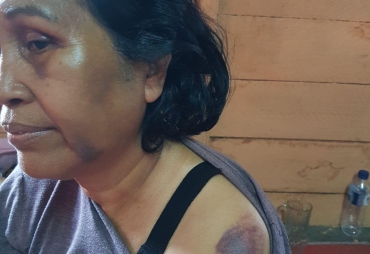 Tampak Korban yang mengalami kesakitan dan sejumlah lebam